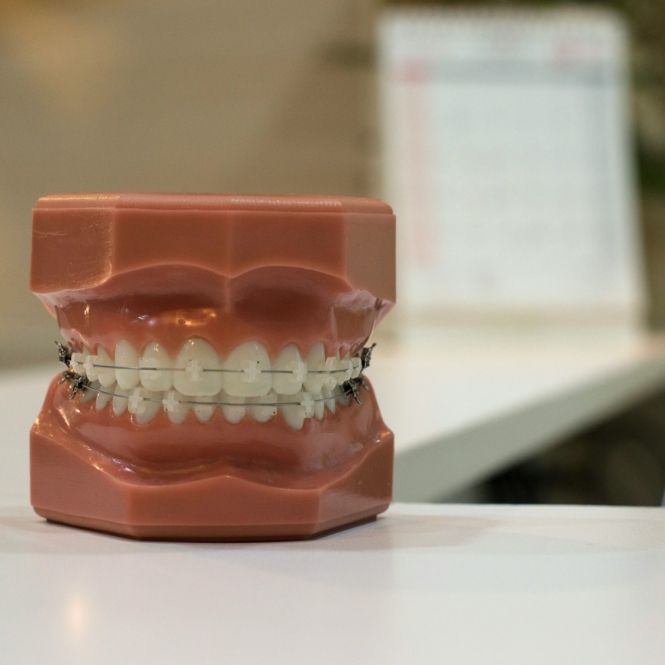 denture on white board